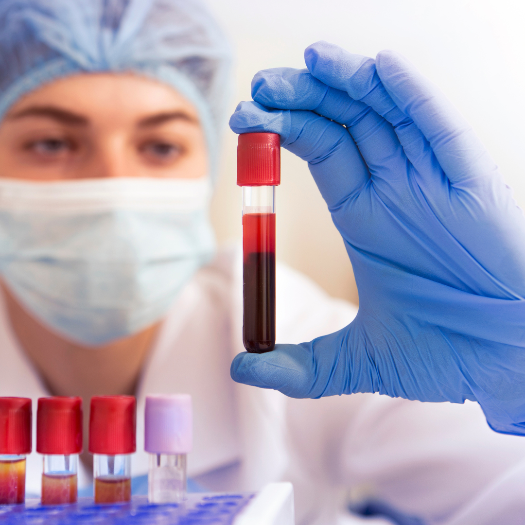 live blood analysis Melbourne